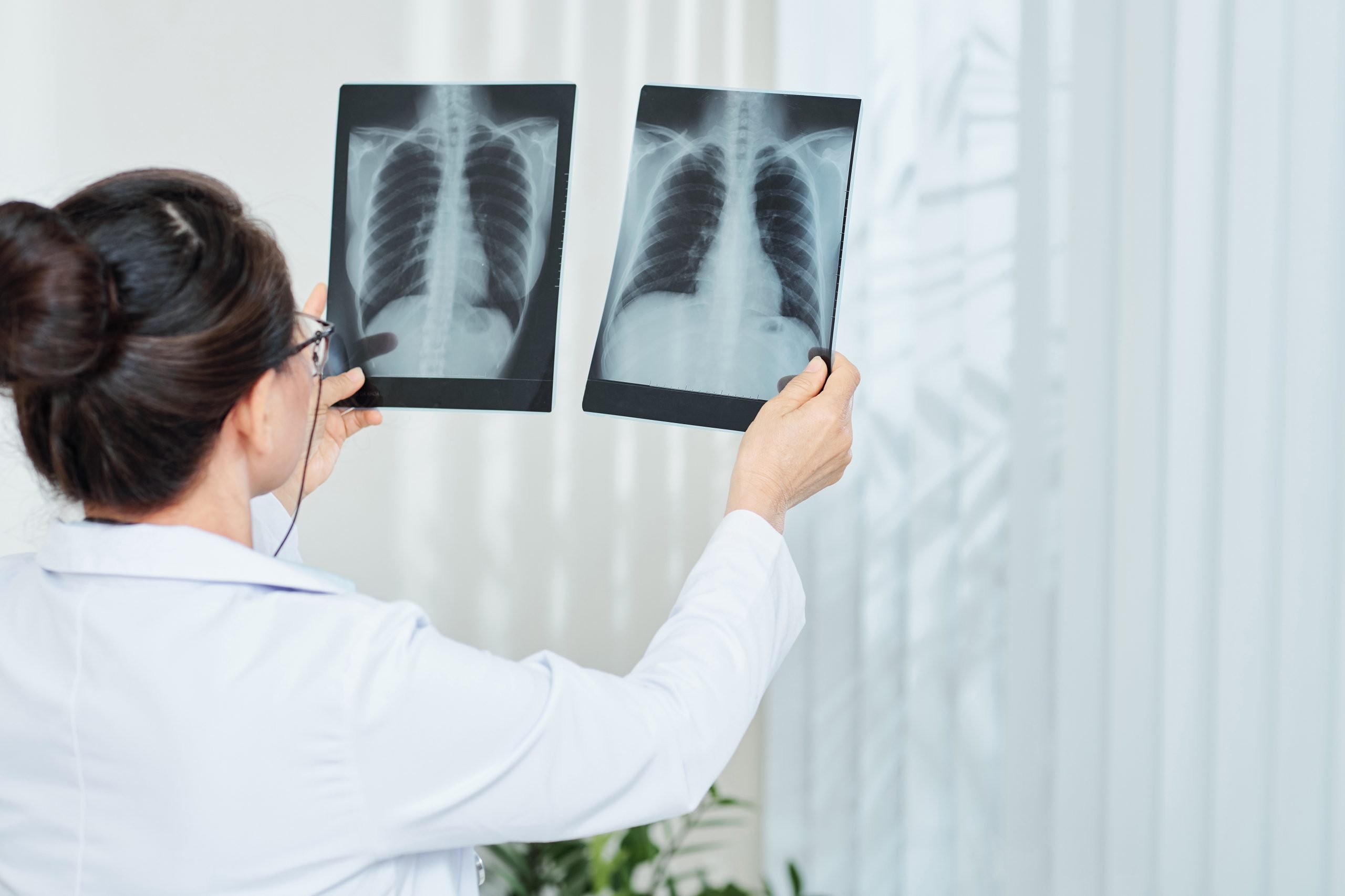 pulmonologist-checking-x-rays-2021-08-28-05-20-25-utc