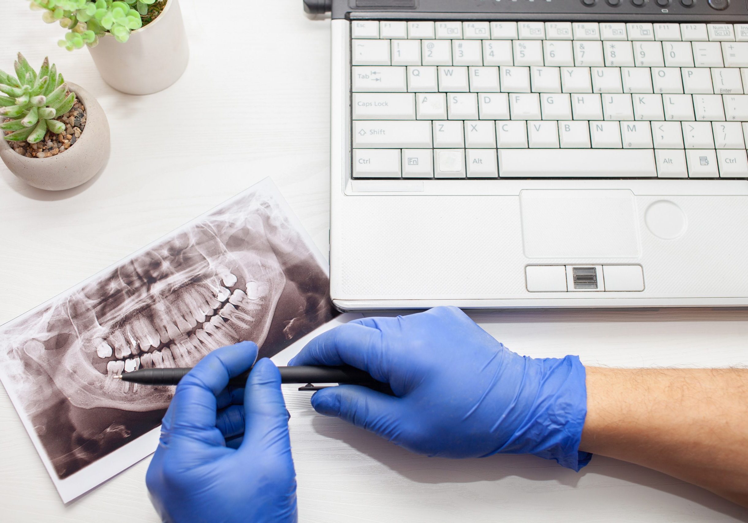 dentist in clinic examines x-ray of jaw of client's patient's teeth modern technologies close up